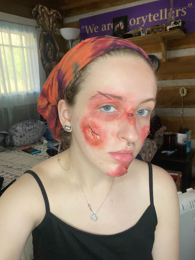 Open Wound class project