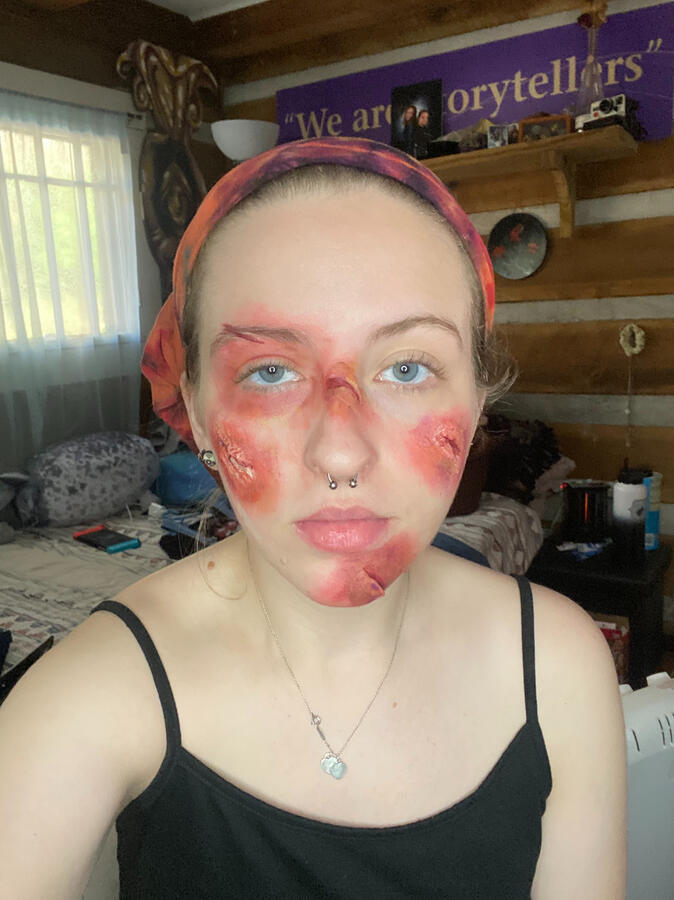 Open wounds class project